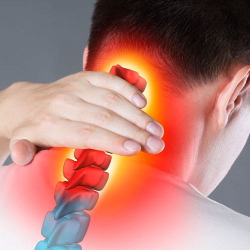 Cervical Disc Arthroplasty