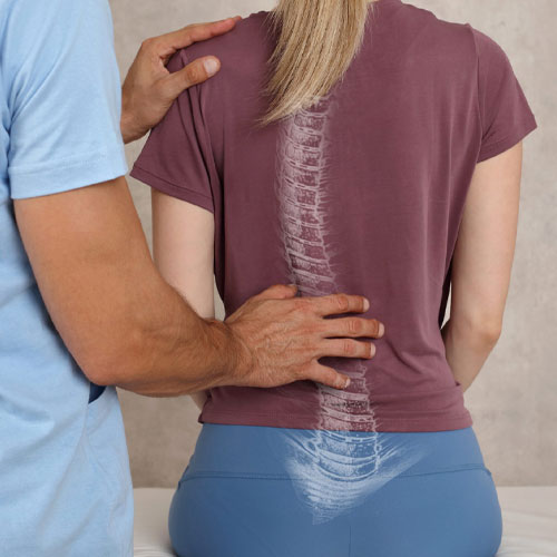 Correction of Complex Spinal Deformity Spinal Reconstruction