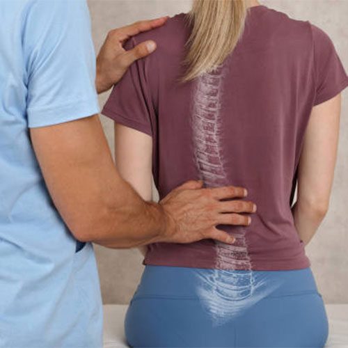 Scoliosis Treatment in Hyderabad
