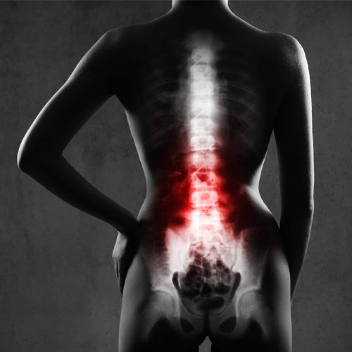 Spinal trauma and tumor surgeries in Hyderabad